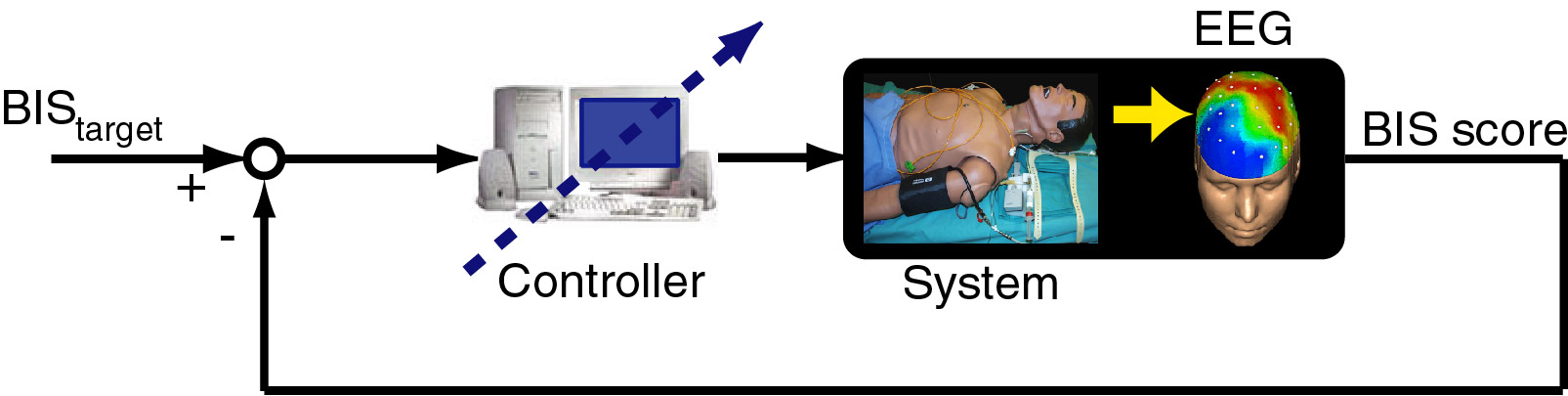 closed-loop system